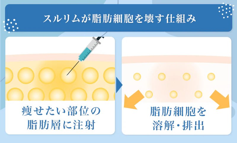 スルリムは引き締めたい部位に薬剤を注入し脂肪細胞を溶解・排出する注射